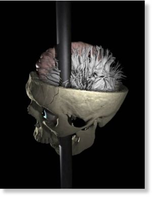 Phineas Gage