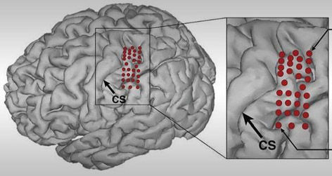 cerebro con una computadora