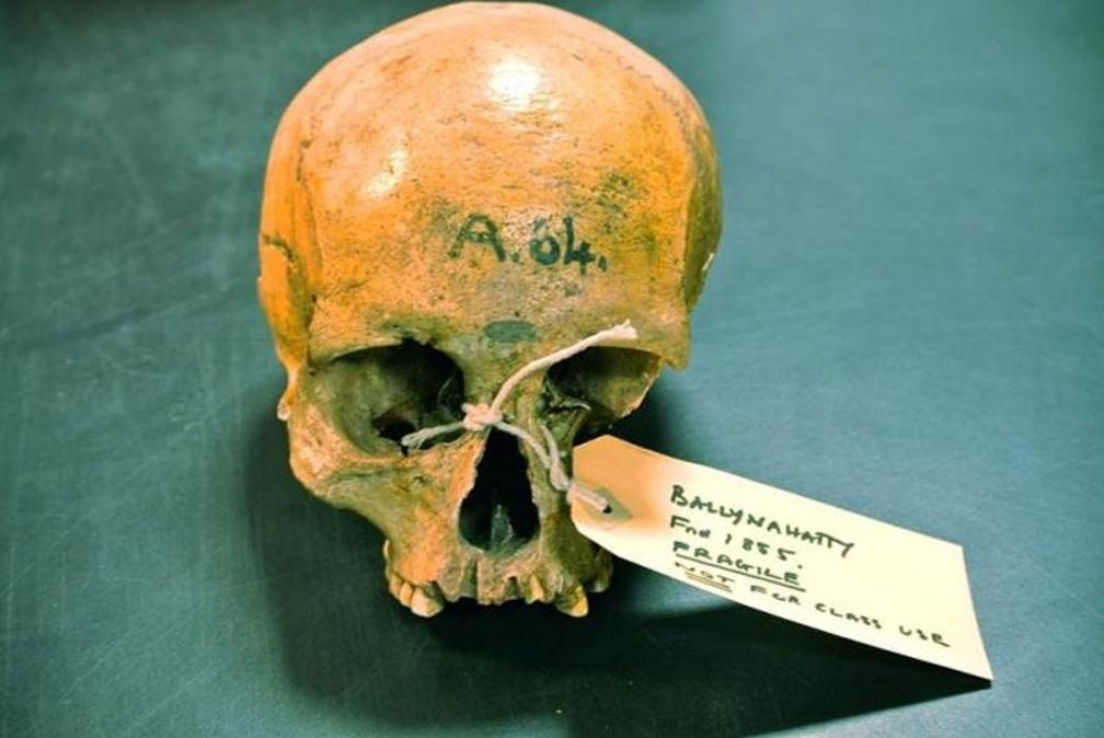 Cráneo mujer Neolítico Irlanda del Norte