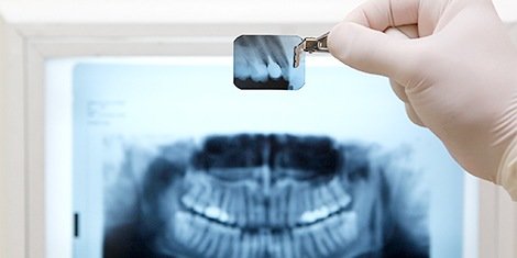 radiografías dentales 