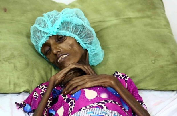 Yemen famine hambruna starvation hambre