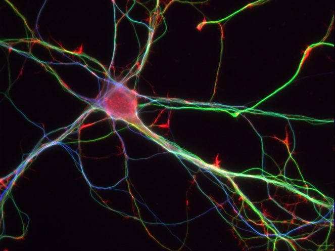Neurona del hipocampo.