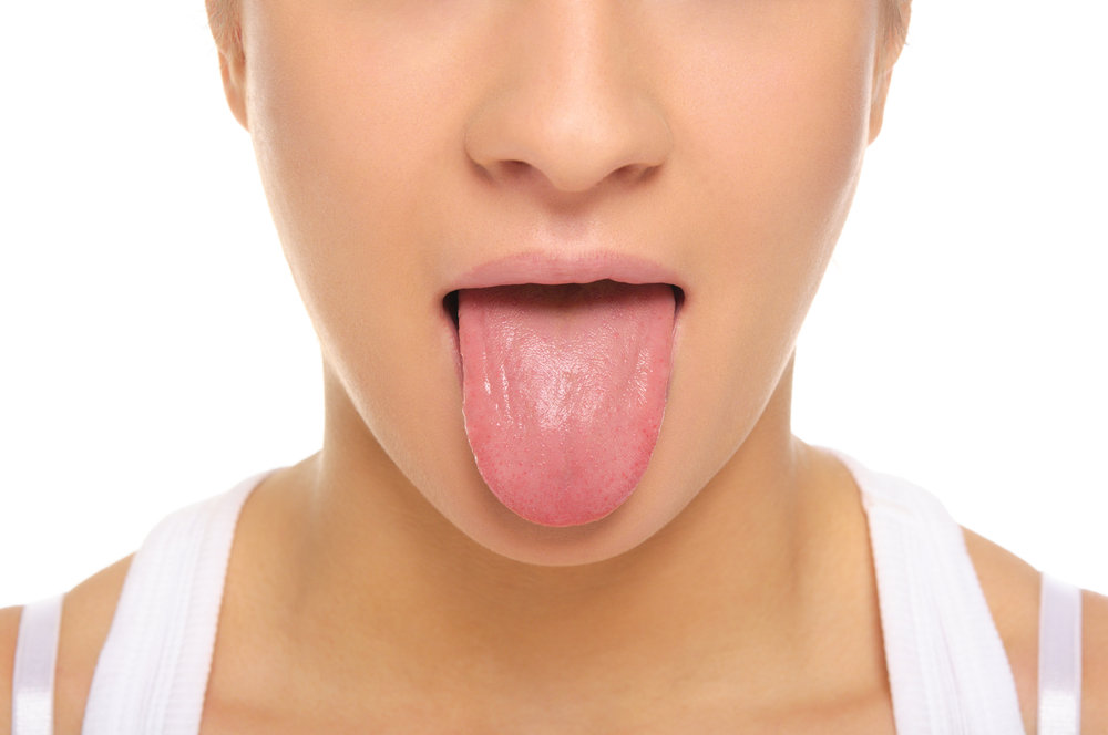 tongue diagnosis