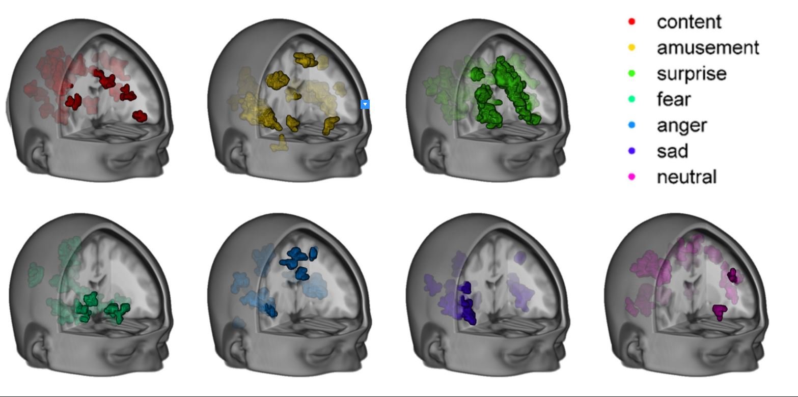 cerebro