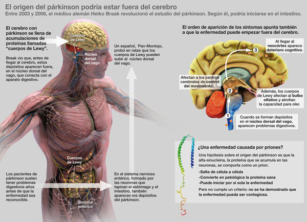infografia parkinson microbioma