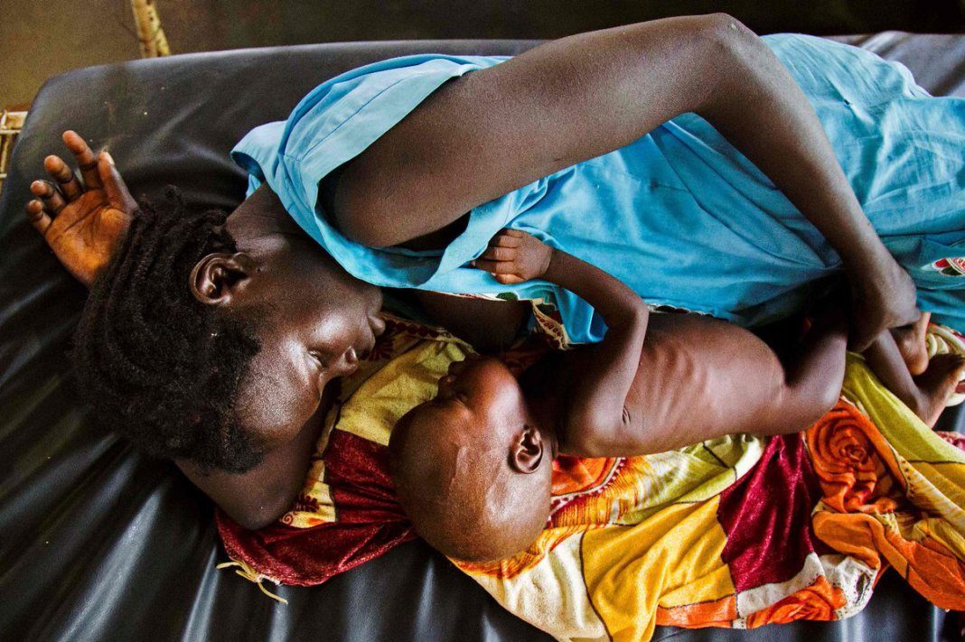 hambruna en Sudán