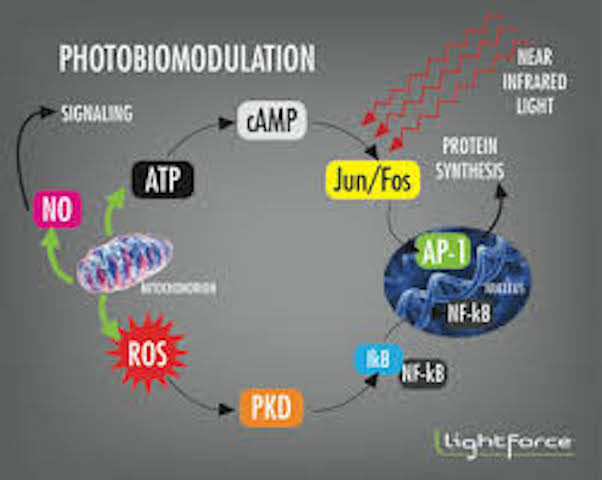photobiomodulation, near infrared therapy