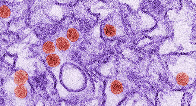 Virus