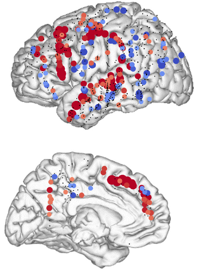 cerebro lenguaje 