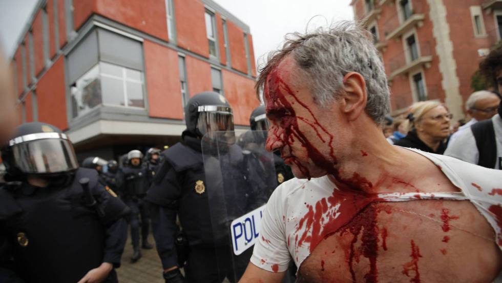 Herido tras la carga policial en la Barceloneta. CARLES RIBAS / EPV
