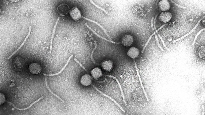 virus