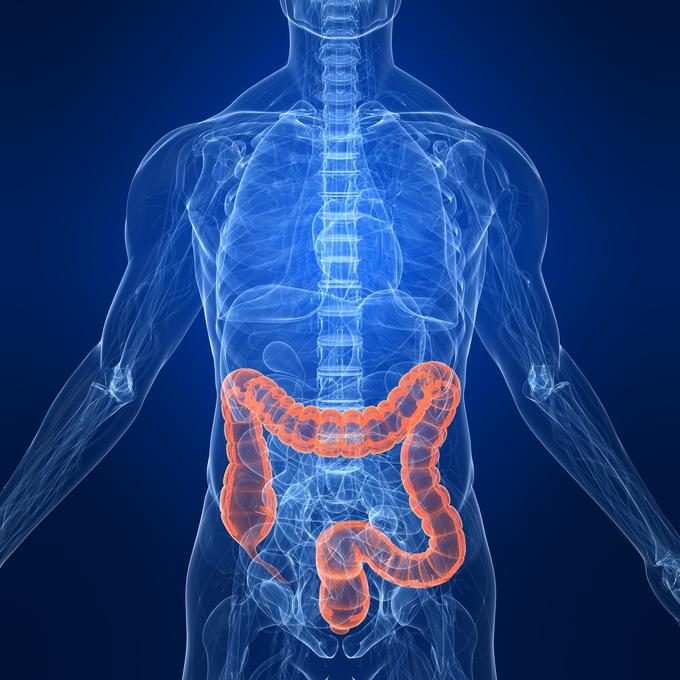 colon cancer