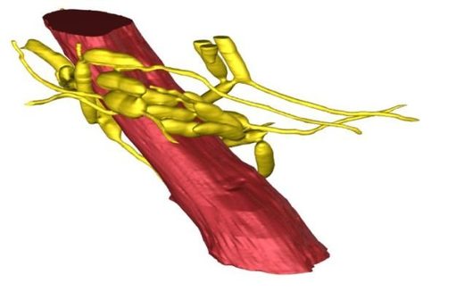 Reconstrucción 3D de un músculo aductor de la mandíbula (rojo) rodeado por una red de células fúngicas (amarillo)
