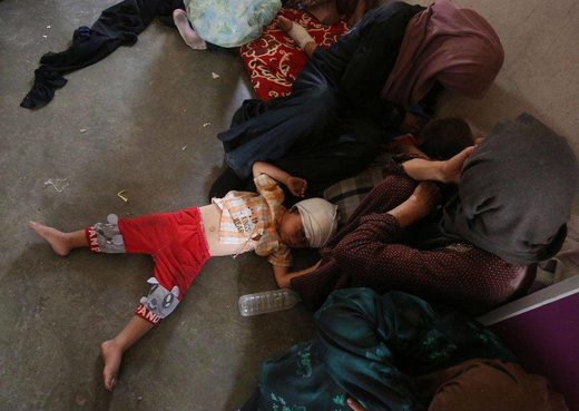 injured child Iraq Irak niño herido