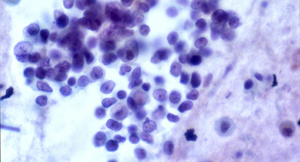 cáncer