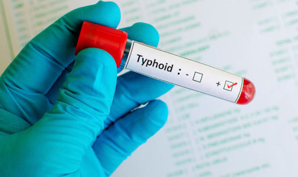 typhus,tifus