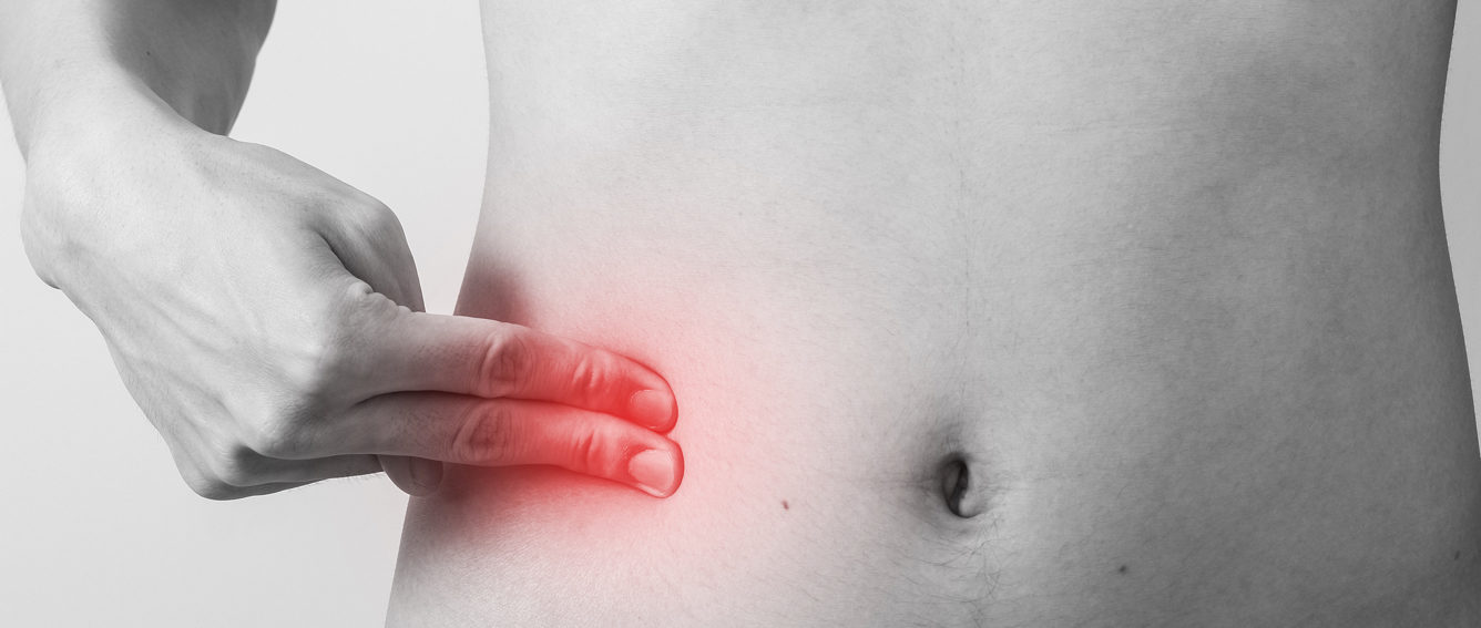 apendicitis