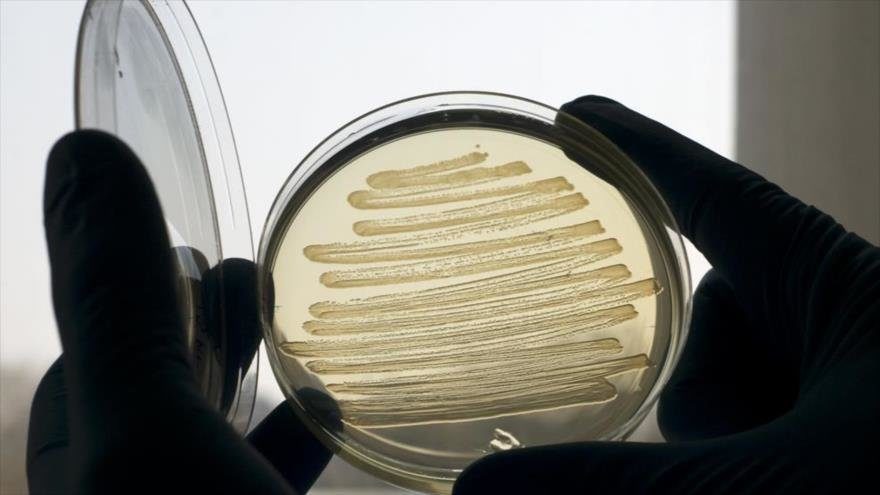petri dish