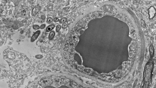 microbiota cerebro