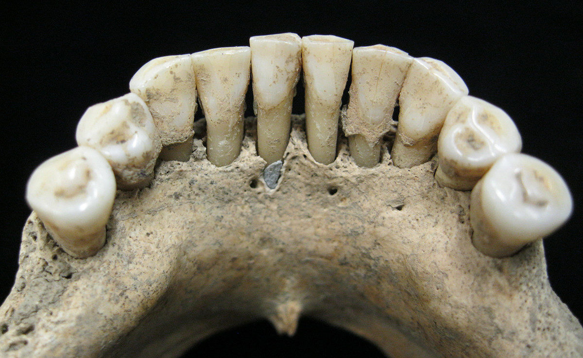 dientes