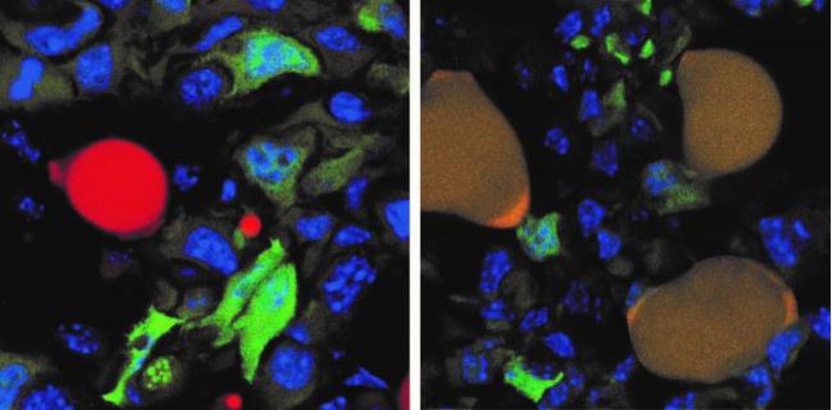 Células cancerosas transformadas en grasa inofensiva,ratones