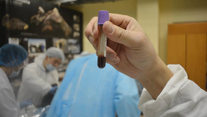blood sample