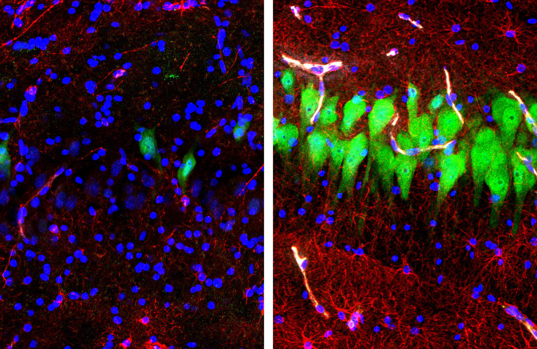 Neuronas