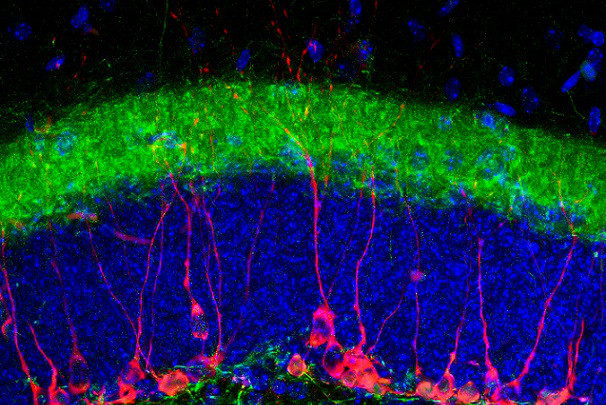Clic para aumentar Tinción de marcadores neuronales