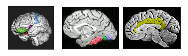 scan del cerebro