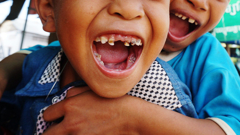 Teeth children