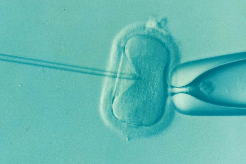 Médicos en Estados Unidos y Europa usaron su propio semen para tratamientos de infertilidad de sus pacientes,escándalo