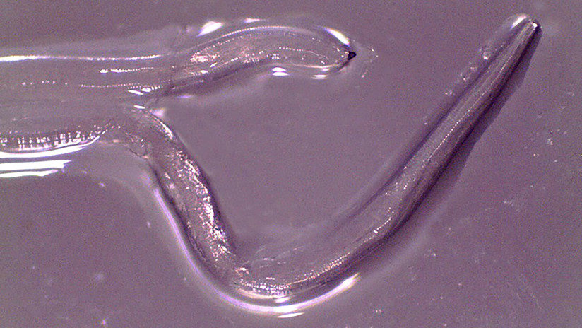 eye worm