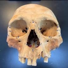 Unos cráneos sugieren que Colón dijo la verdad sobre el canibalismo de los indios del Caribe