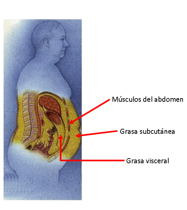 adiposidad visceral