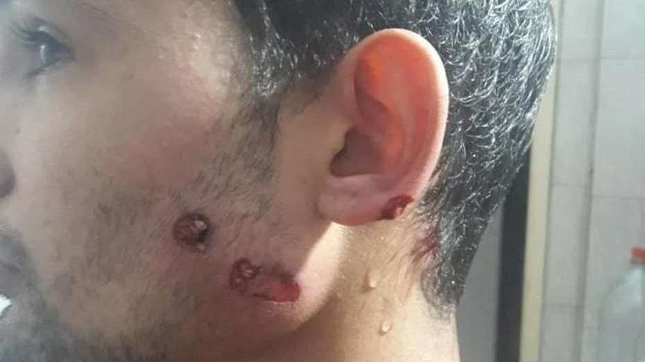 Fue a comprar pan y un policía le disparó con balas de goma por “incumplir la cuarentena
