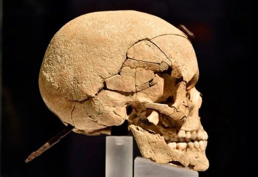 Encuentran evidencias de cirugía en un guerrero que vivió hace 1500 años
