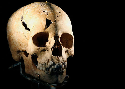 Encuentran evidencias de cirugía en un guerrero que vivió hace 1500 años