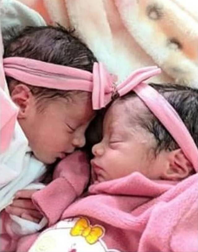 The newborn sister twins died.