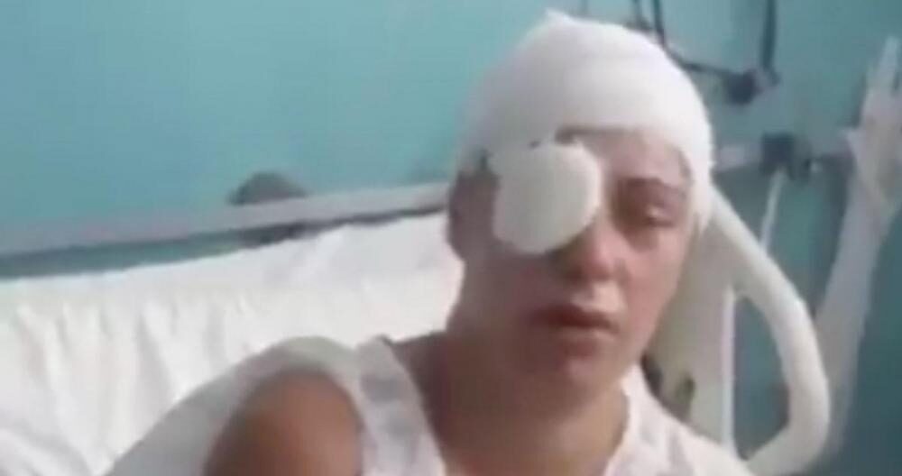 La mujer agredida con ácido en Sant Feliu de Guíxols, España: 