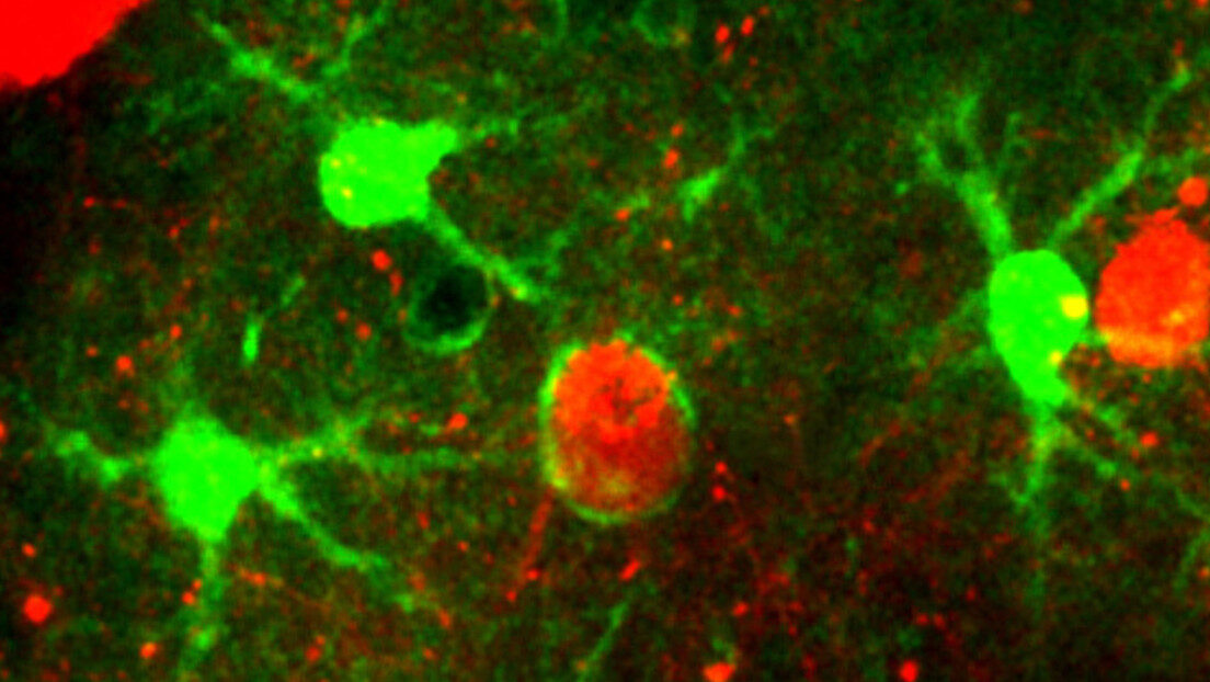 Han filmado por primera vez cómo el cerebro se deshace de las neuronas muertas