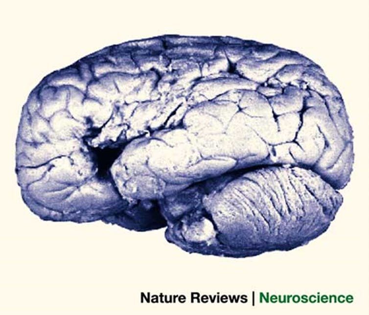 Vista lateral del cerebro