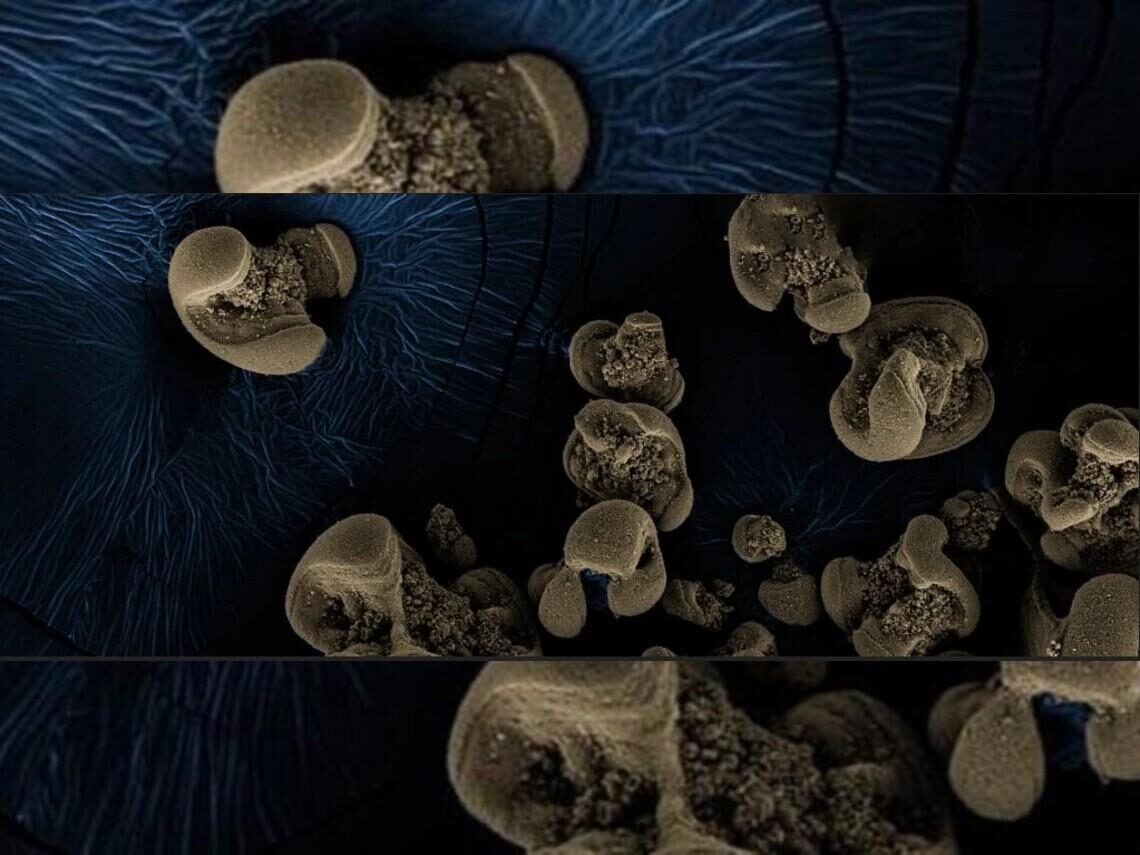 bacteria
