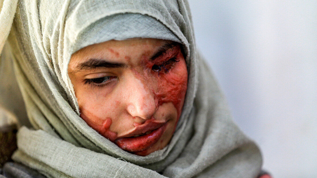 yemen acid attack