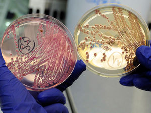 e.coli petri