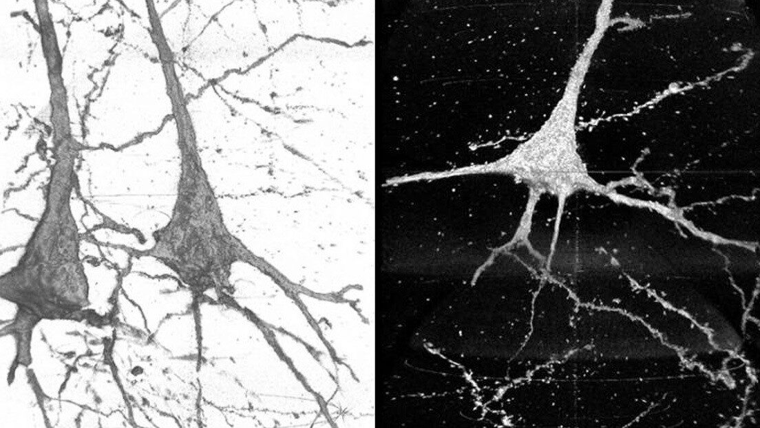 neuronas