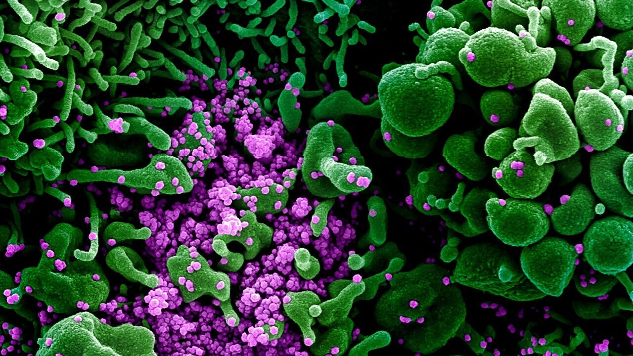 virus infection