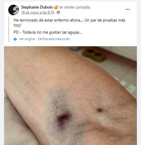 Clic para aumentar Relato Espantoso,muere,modelo artística,Stephanie Dubois,vacunarse,AstraZeneca