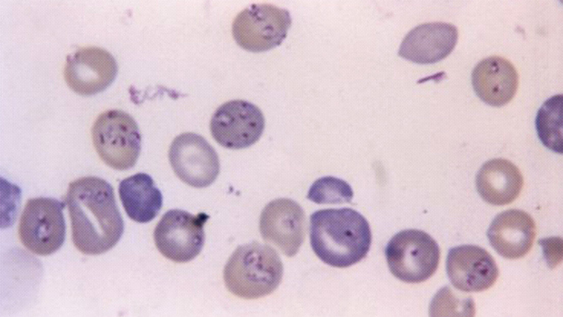 globules rojos