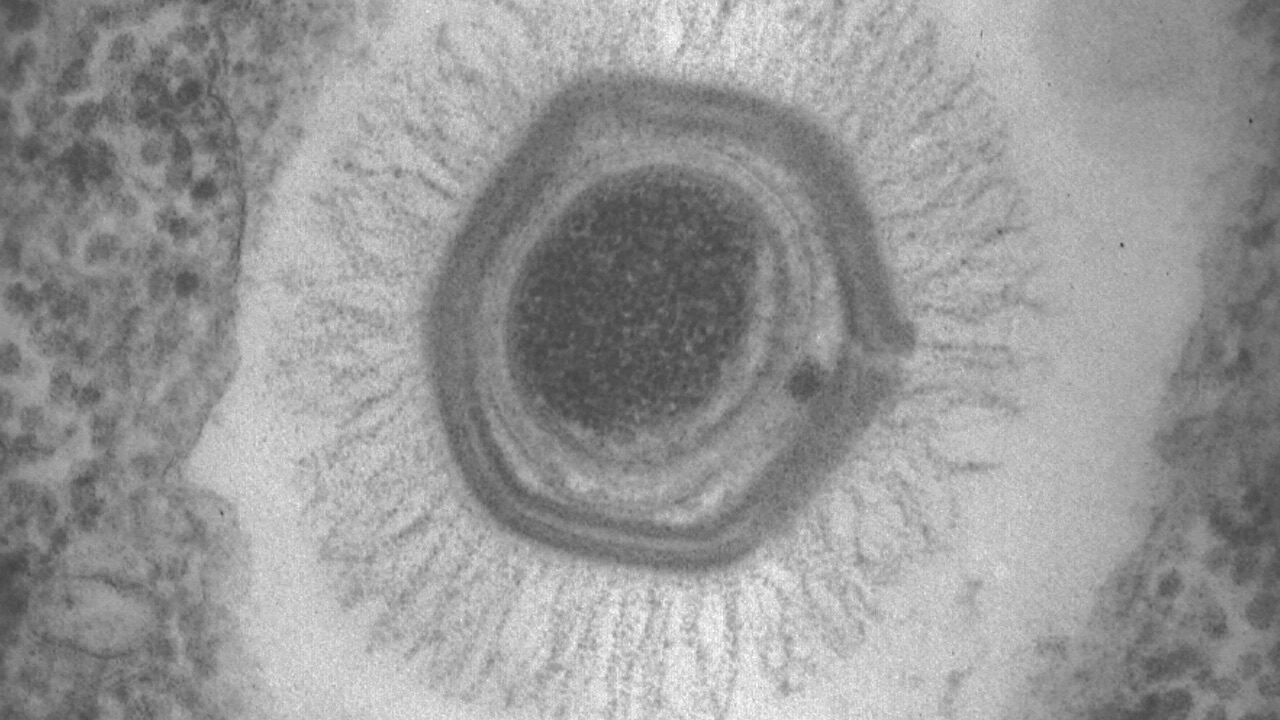 giant virus