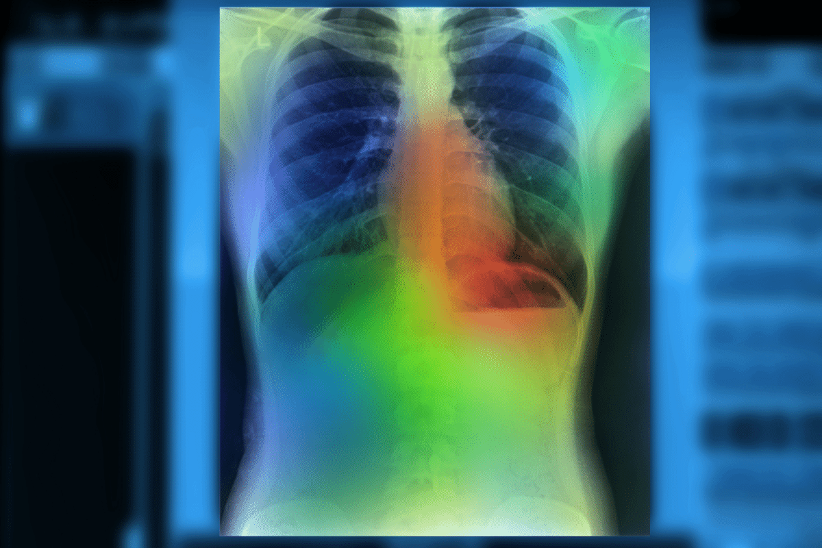 medical diagnosis artificial intelligence